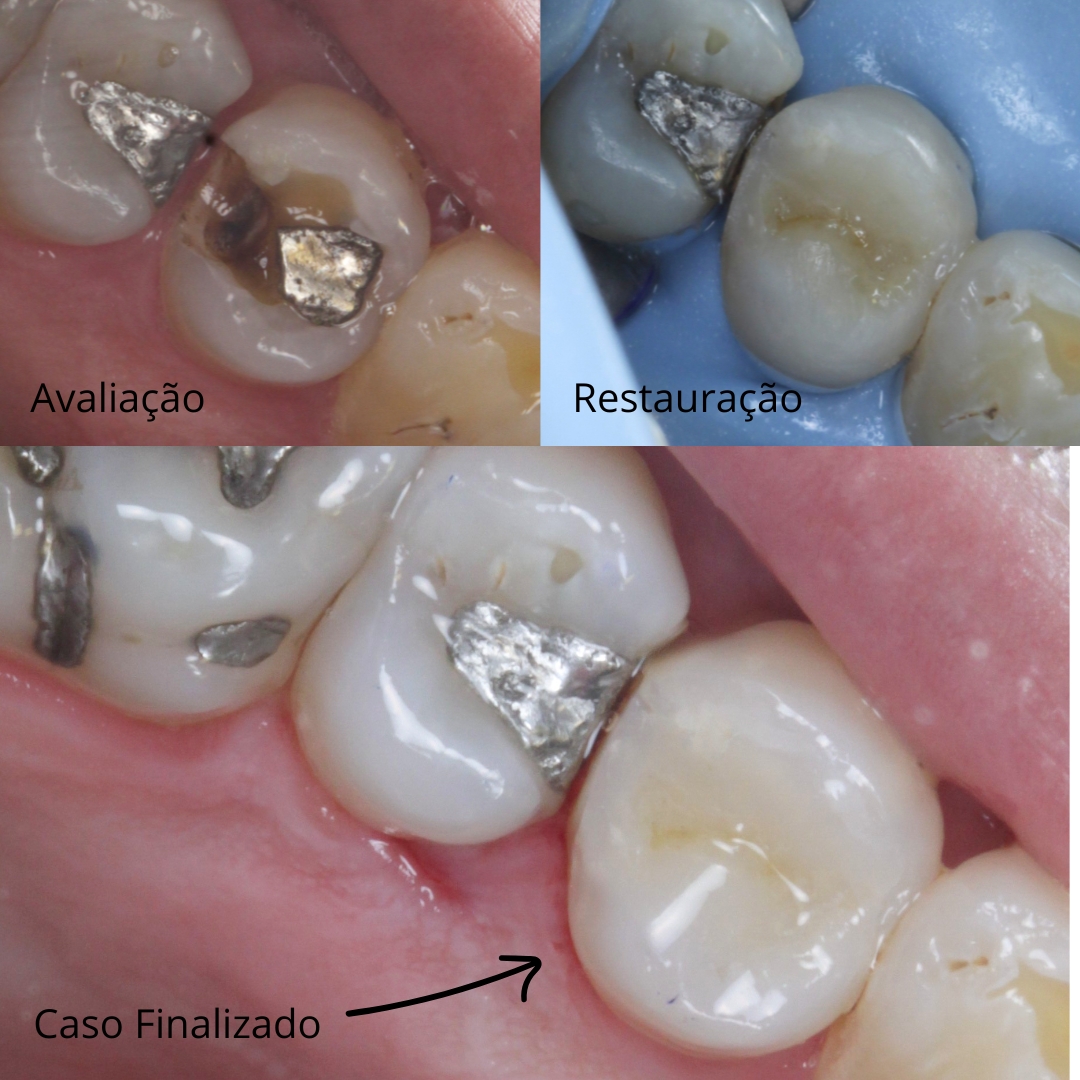 Restauração